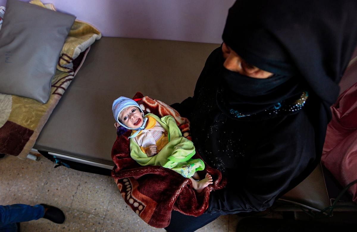 A child suffering from malnutrition lies in the lap of a woman at a treatment centre in al-Sabeen Maternal Hospital in the Huthi-rebel-held Yemeni capital Sanaa on June 22, 2019. (AFP)