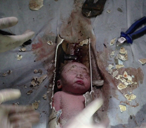 Firefighters and doctors rescue an abandoned newborn baby boy by cutting away a sewage pipe piece by piece, in this still image taken from video, in Jinhua city, Zhejiang province May 25, 2013. Reuters