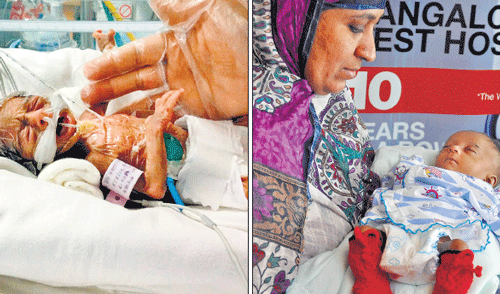 rebirth: The baby born premature weighed just 470 gm. (Right) It is healthy now and in the mother's arms.