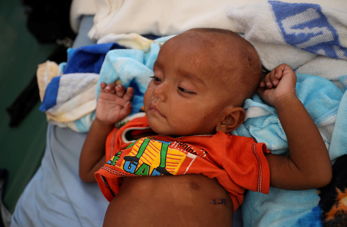 Halima, 1, a Rohingya refugee boy, receives treatment for pneumonia in the Red Cross emergency hospital near Kutupalong refugee camp near Cox's Bazar, Bangladesh October 28, 2017. REUTERS/File Photo