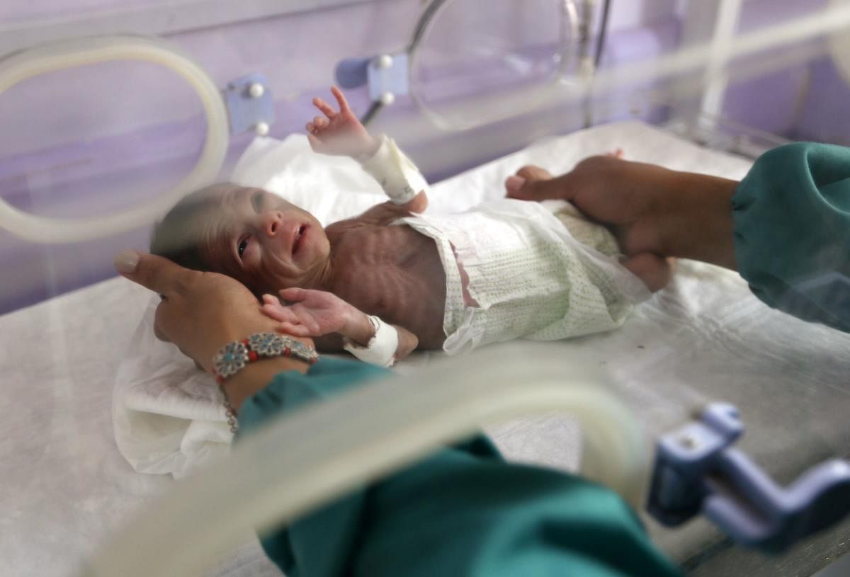 However, they said, the lack of adequate oxygen supply to the body, or hypoxia, inhibited natural breathing, and was a huge risk for premature babies. (Photo by AFP)