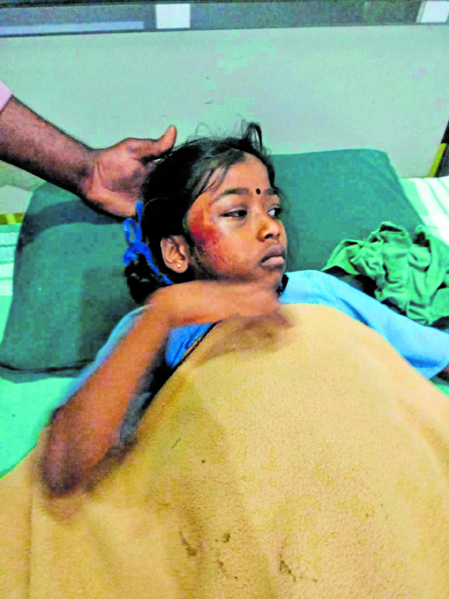 Yuvashree, the injured girl.