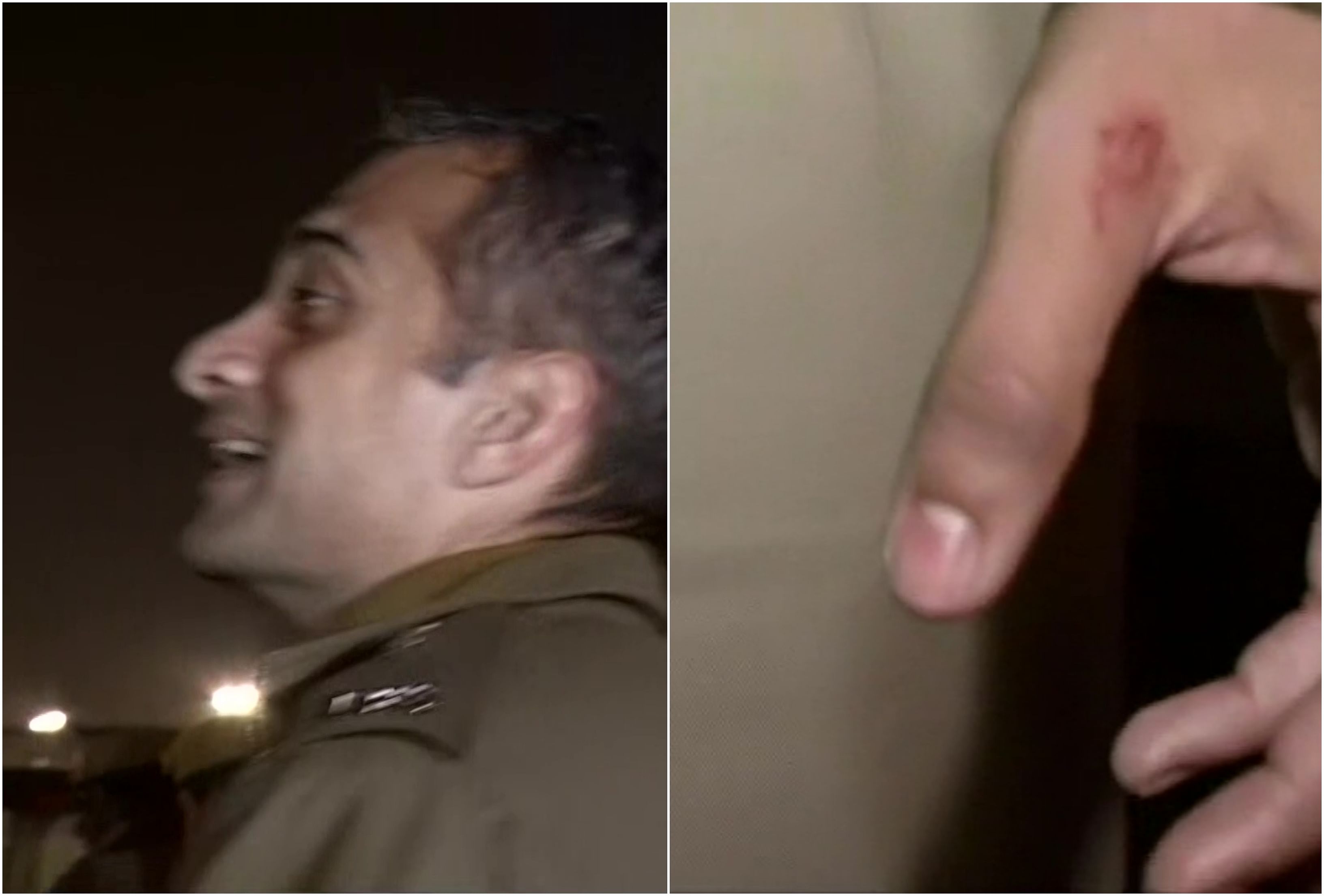 Ingit Pratap Singh, a 2011 batch officer, who is currently posted as the additional deputy commissioner of southwest district, was injured in the attack. Credit: ANI