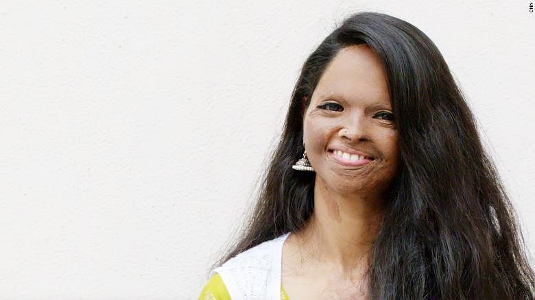 But what is truly remarkable is that the acid cannot destroy the indomitable human spirit. Bright, beautiful and inspiring Laxmi Agarwal is herself living proof. (DH Photo)