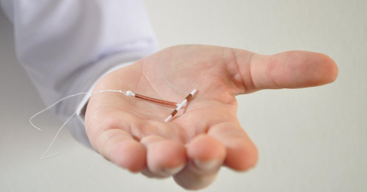 Debunking Myths About Iud