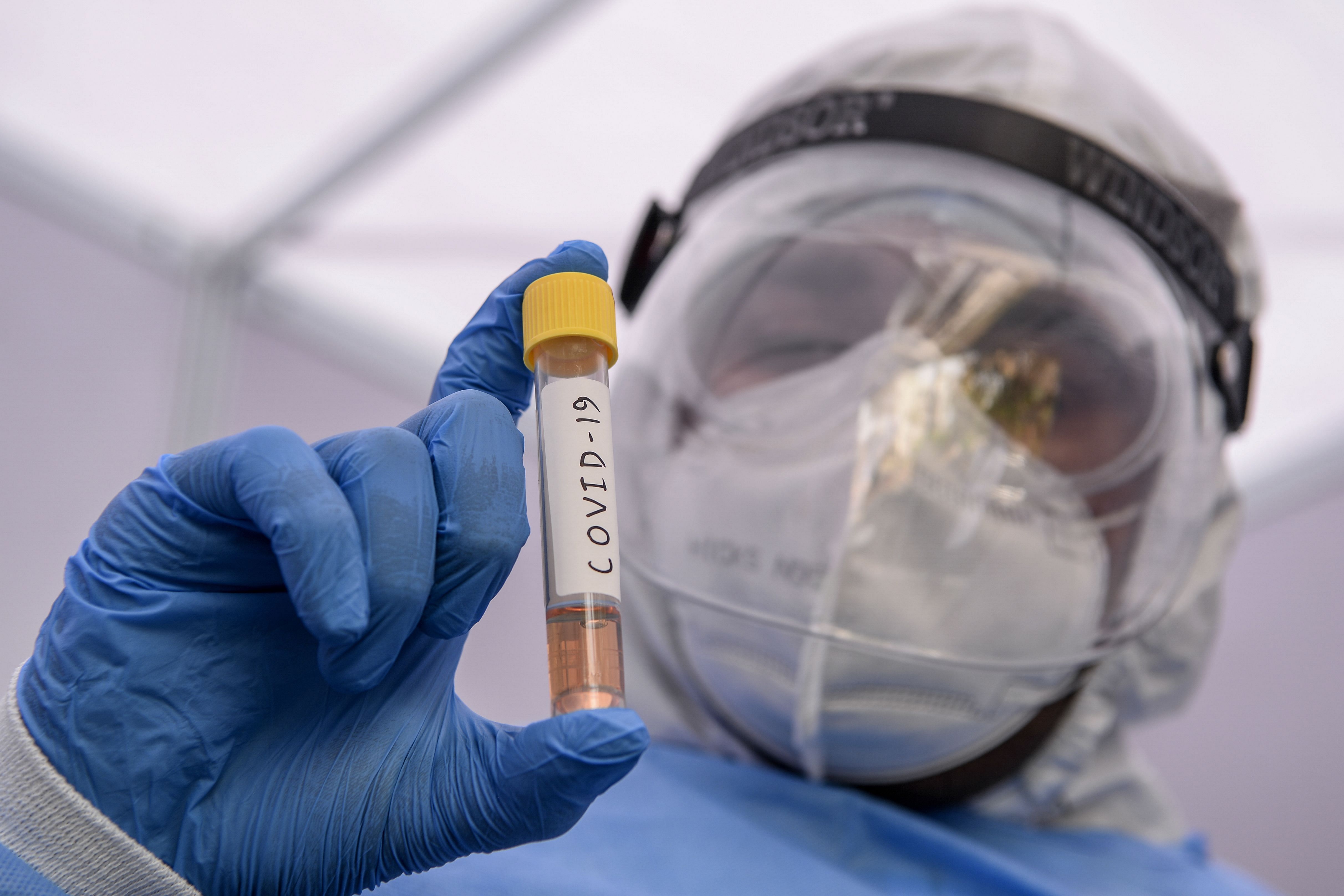 A laboratory technician from Dr. Dangs Lab displays a coronavirus testing tube during a government-imposed nationwide lockdown in New Delhi. (Credit: PTI)