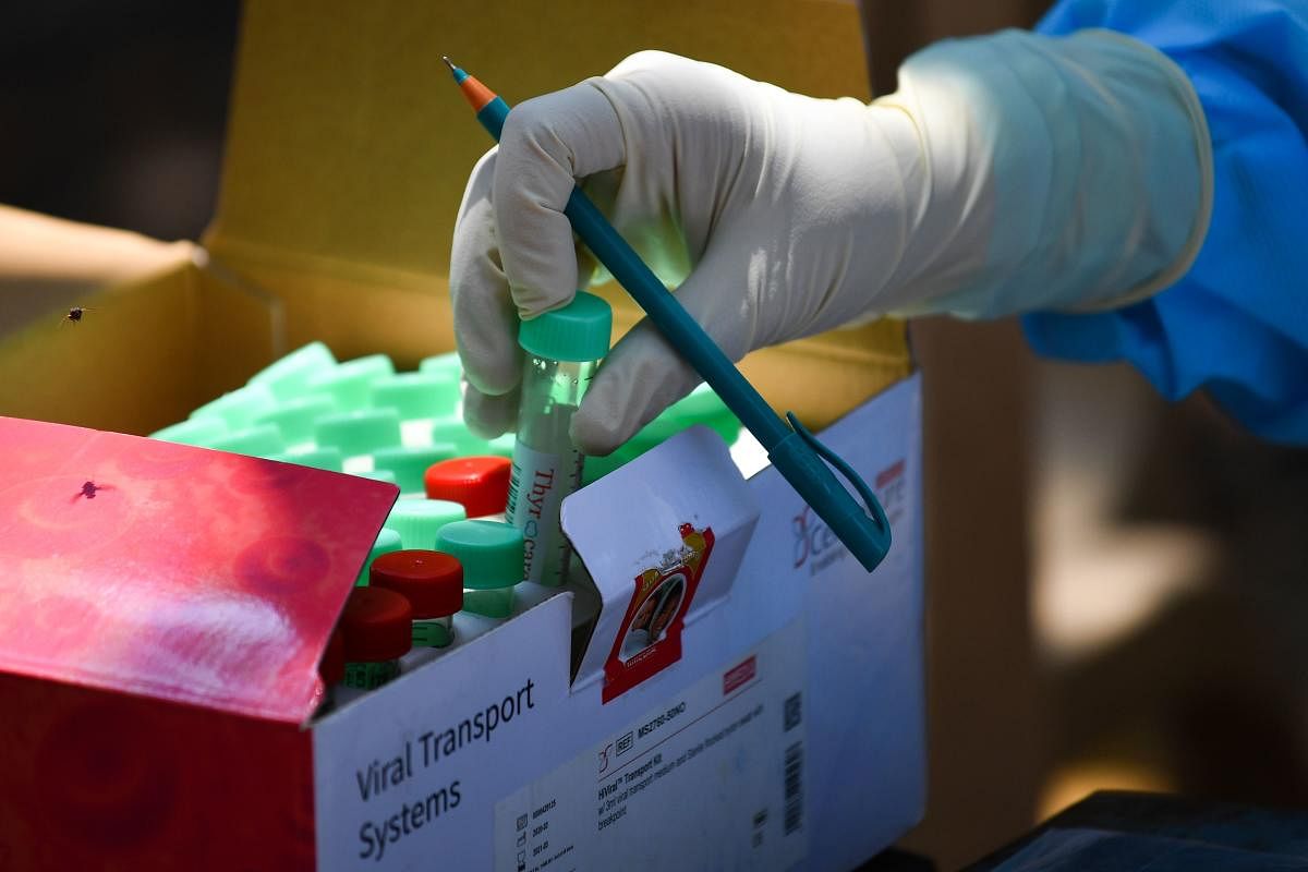 A doctor places a viral transport system swab sample tube during a COVID-19 coronavirus testing drive inside the Dharavi slums during a government-imposed nationwide lockdown as a preventive measure against the spread of the COVID-19 coronavirus, in Mumbai on April 16, 2020.  Credit: AFP Photo