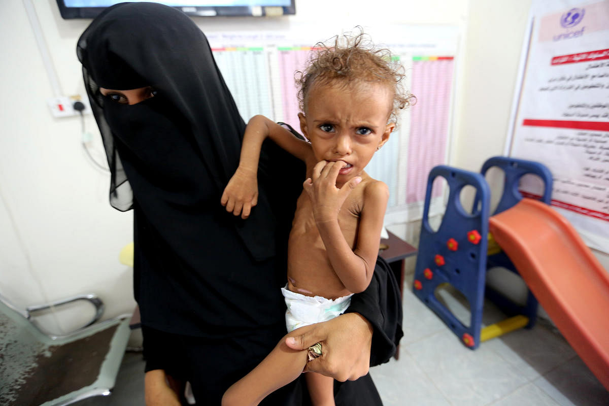 Mother of malnourished Ferial Elias, 2, holds her at a malnutrition treatment ward at al-Thawra hospital in Hodeidah, Yemen November 3, 2018. Picture taken November 3, 2018. REUTERS/Abduljabbar Zeyad