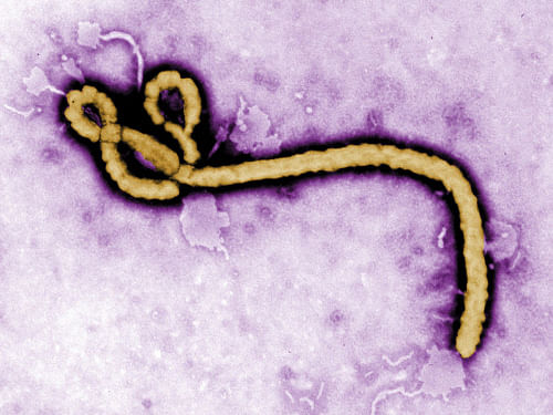 Some of the ultrastructural morphology displayed by an Ebola virus virion is revealed in this handout colorized transmission electron micrograph. The World Health Organisation on Saturday warned west Africa's Ebola-hit nations that the epidemic was spiralling out of control and could spread to other countries, causing 'catastrophic' loss of life and severe economic disruption. Reuters photo
