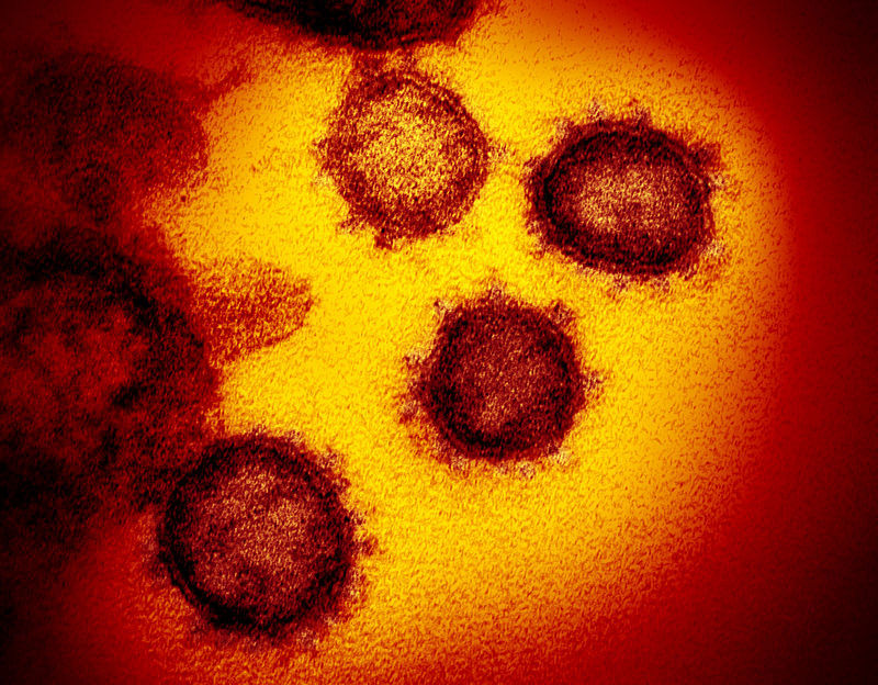 This image of the virus is from a transmission electron microscope. (Credit: NIAID Photo)