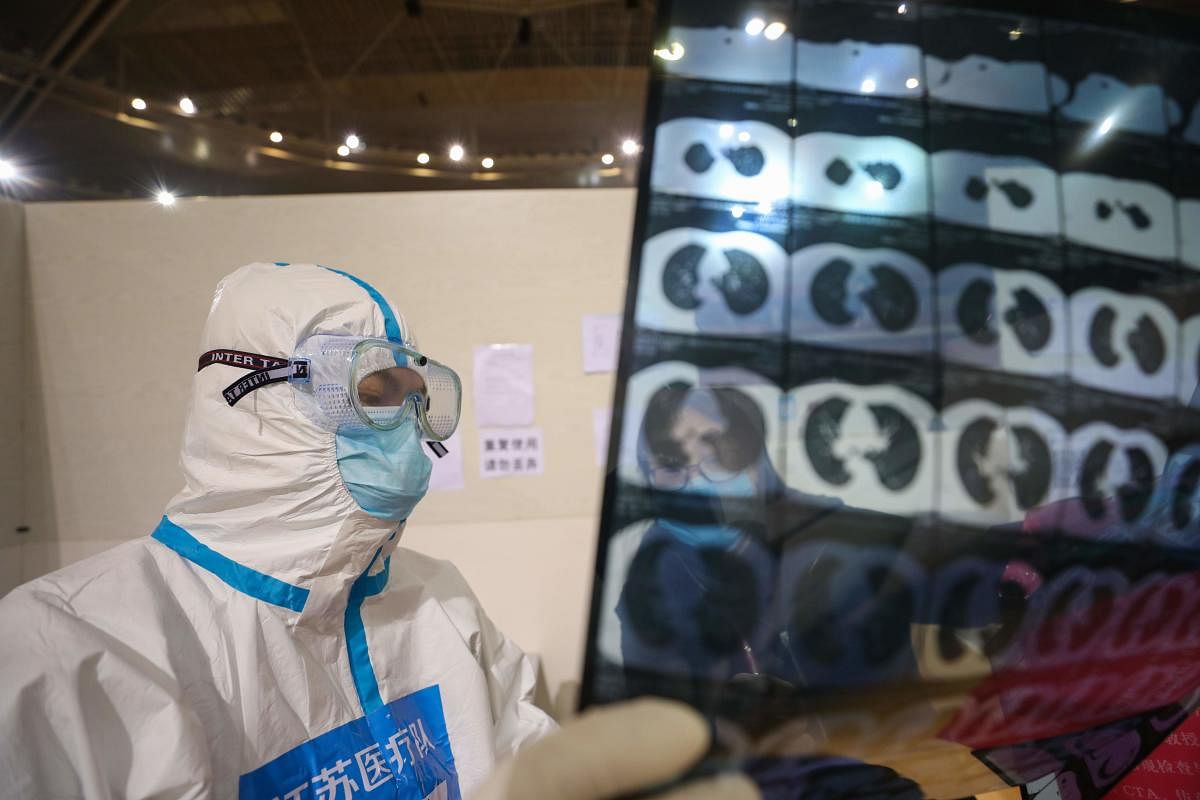 This photo taken on March 5, 2020 shows a doctor looking at a patient's CT scan at a temporary hospital set up for COVID-19 coronavirus patients in a sports stadium in Wuhan, in China's central Hubei province. Credit: Reuters Photo