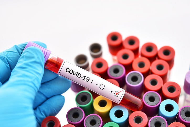 Blood sample tube positive with COVID-19 (iStock image for representation)