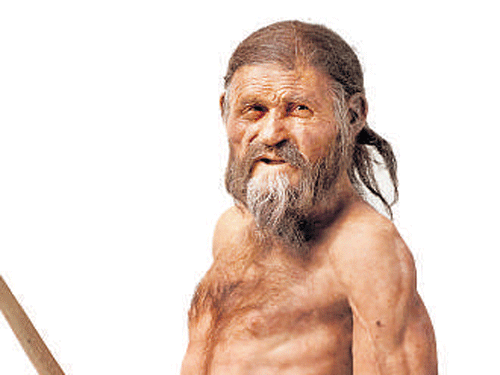 Otzi the Iceman  had a stomach bug