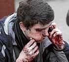 A wounded man makes a phone call outside the Park