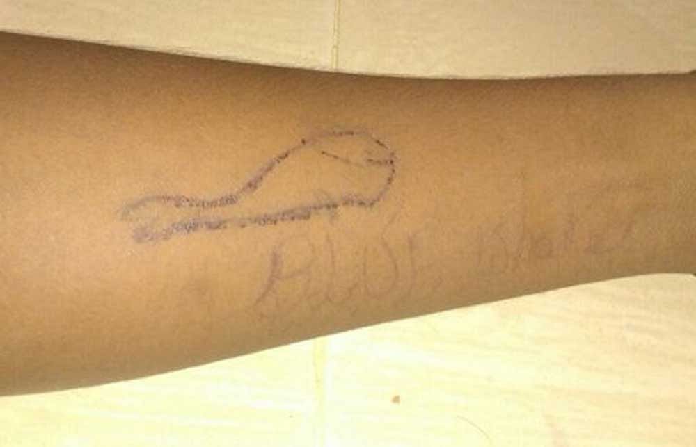 The drawing of a whale cut into the hand of Vignesh, who killed himself at the end of the challenge. Photo: Twitter.