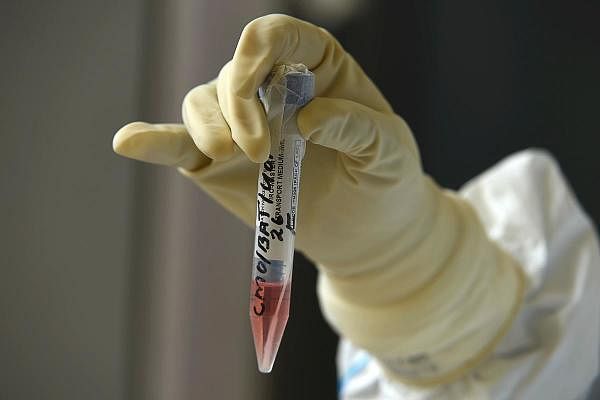 A Chinese laboratory has been developing a drug it believes has the power to bring the coronavirus pandemic to a halt. (Credit: Representative image/AFP Photo)