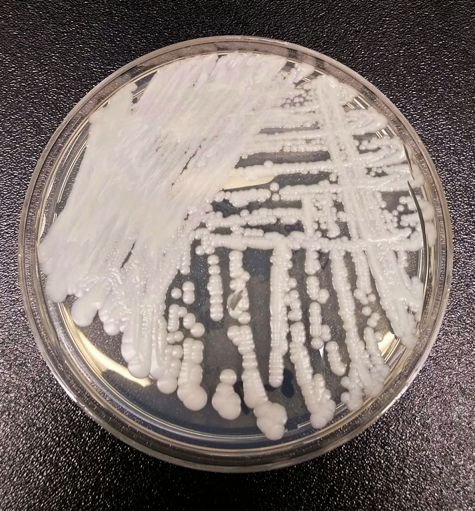 A strain of Candida auris cultured in a petri dish at a CDC laboratory. Date	29 September 2016. Credit:  Centers for Disease Control and Prevention. 