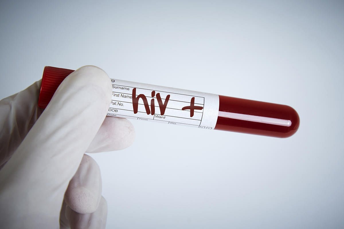 Blood sample with HIV+ (Image for representation/Getty Image)