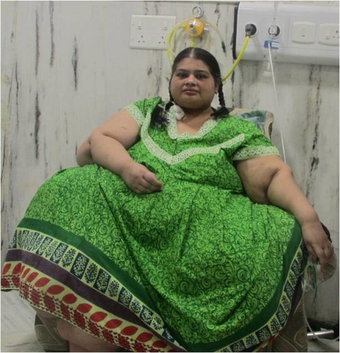 Pre-operation, Amita weighed around 300 kg.