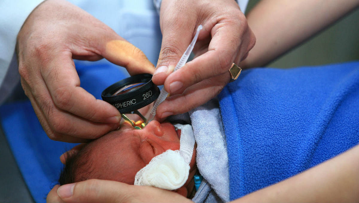 Infant undergoing treatment for Retinopathy of Prematurity