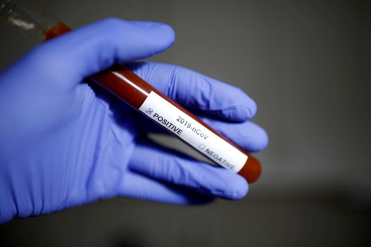 FILE PHOTO: Test tube with Coronavirus name label