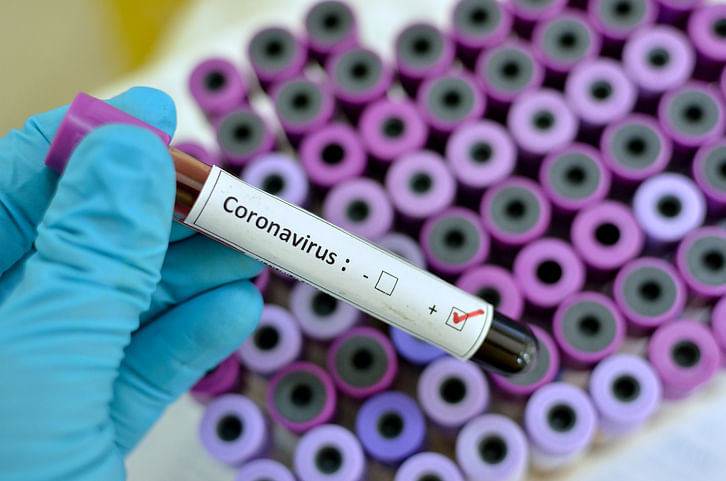 Blood sample with respiratory coronavirus positive (Image for representation/iStock Photo)