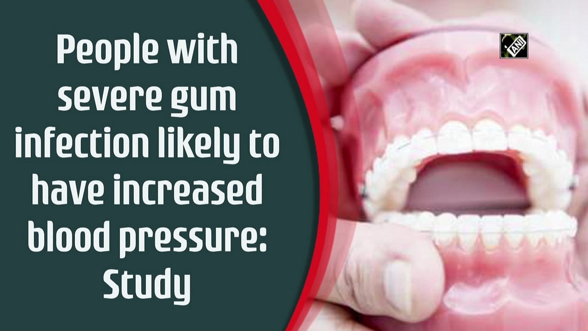 People with severe gum infection likely to have increased blood