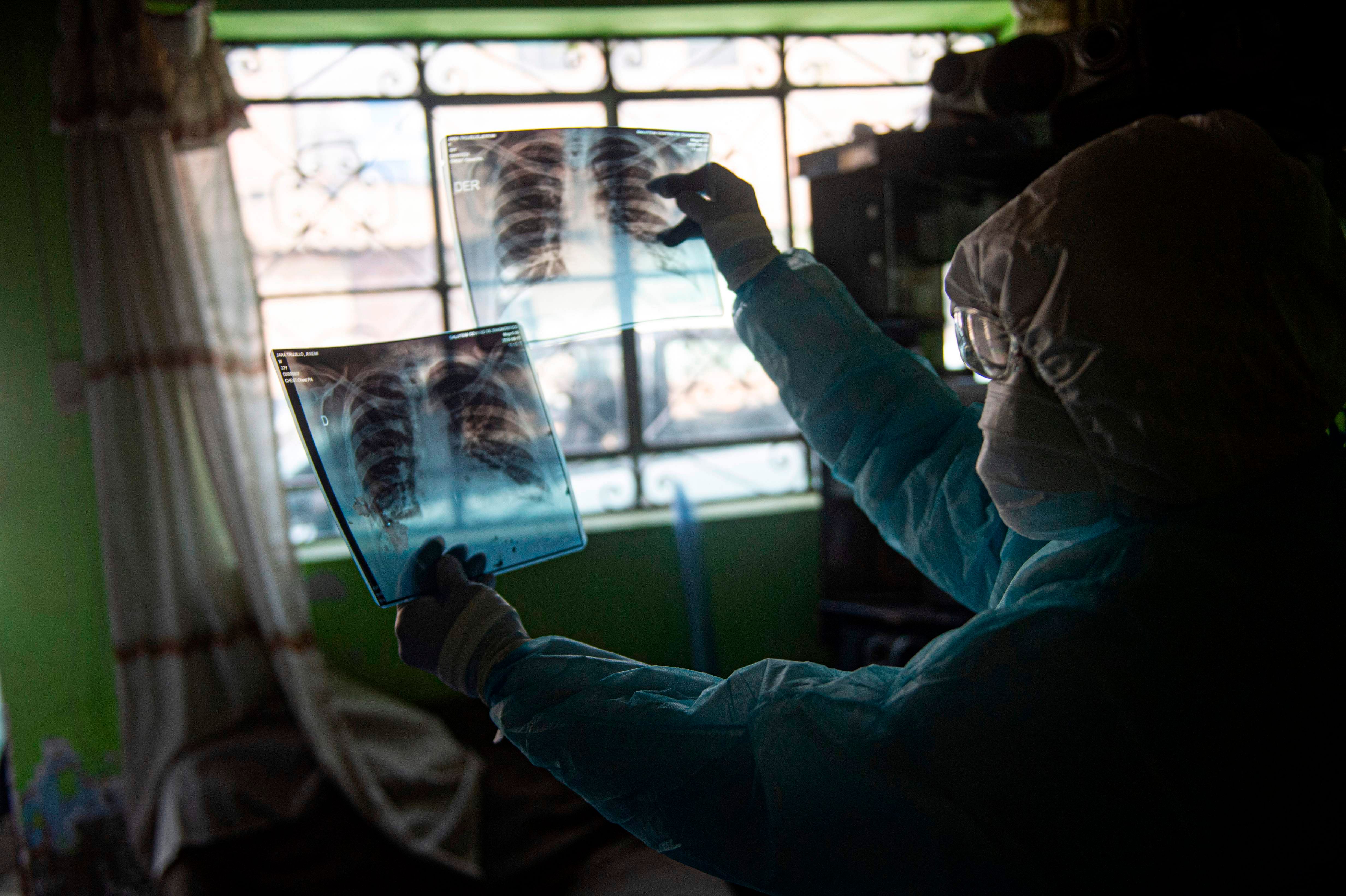 Two children required special oxygen support due to severe heart dysfunction, they said. Credit: AFP Photo