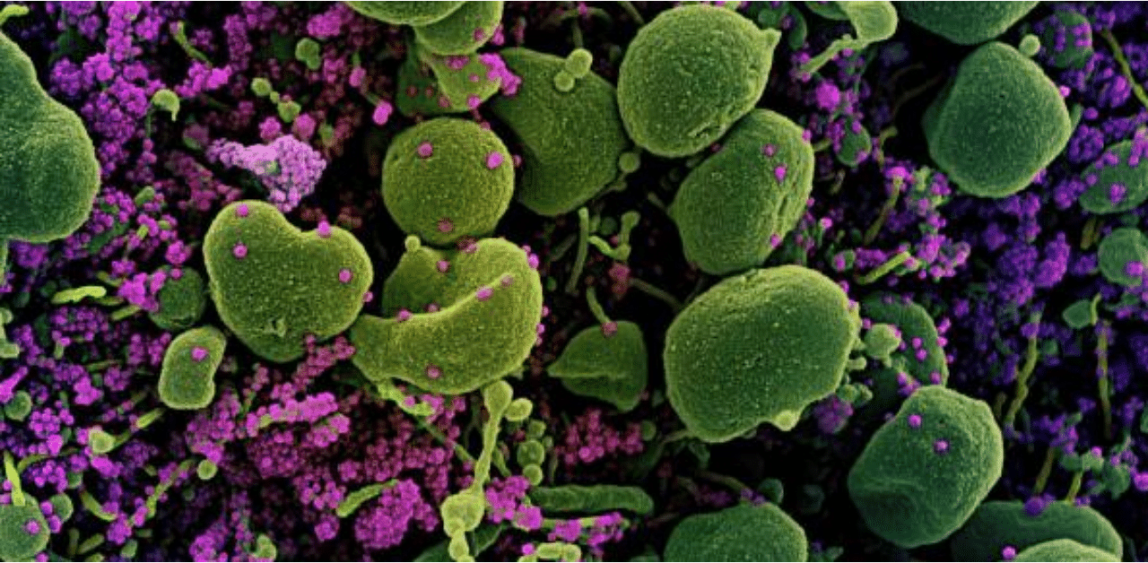 A colorized scanning electron micrograph of an apoptotic cell (green) heavily infected with SARS-CoV-2 virus particles (purple), isolated from a patient sample, captured at the NIAID Integrated Research Facility (IRF). Credit: AFP
