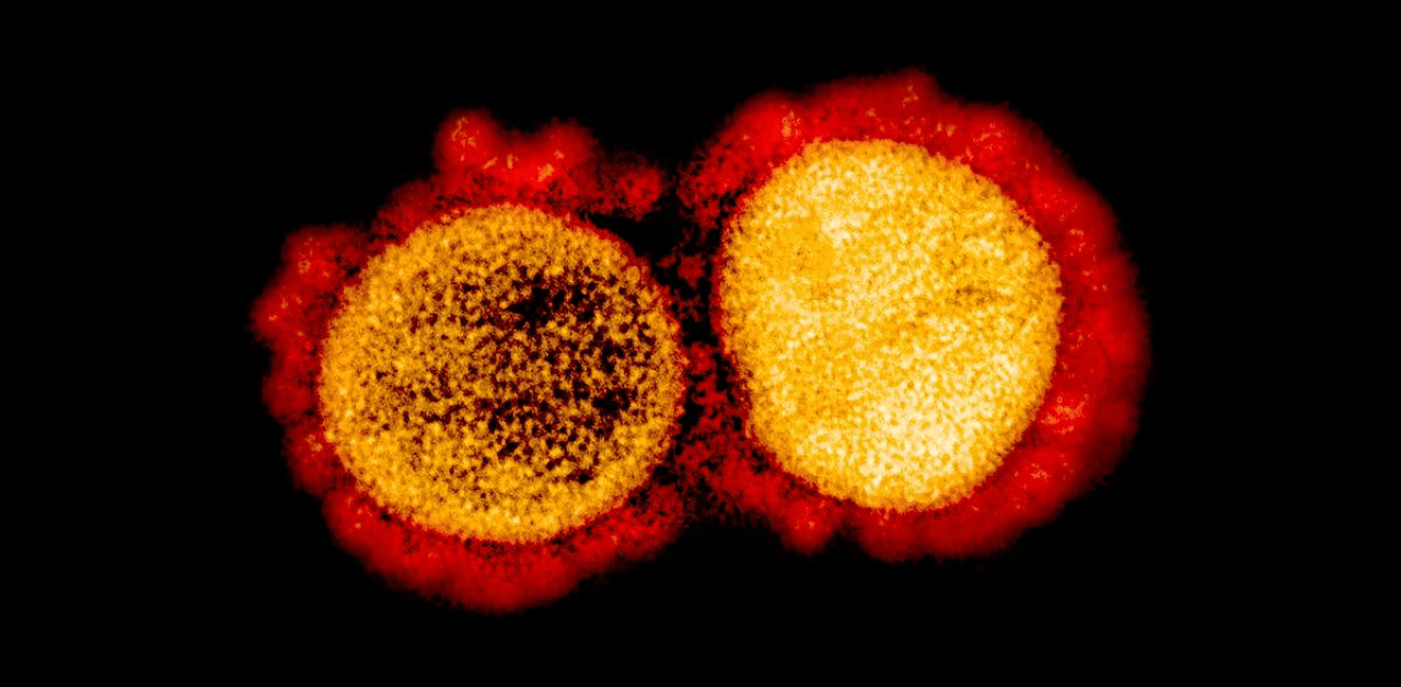 The researchers, including those from Northwestern University in the US, noted that the spike protein contains the virus' binding site, which adheres to host cells and enables it to enter and infect the body. Credit: AFP Photo