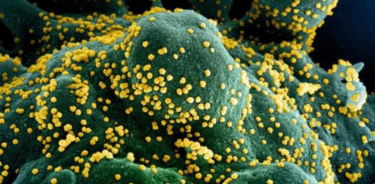 A colorized scanning electron micrograph of an apoptotic cell (blue/green) heavily infected with SARS-COV-2 virus particles (yellow), isolated from a patient sample, captured at the NIAID Integrated Research Facility (IRF) in Fort Detrick, Maryland. Credit: AFP