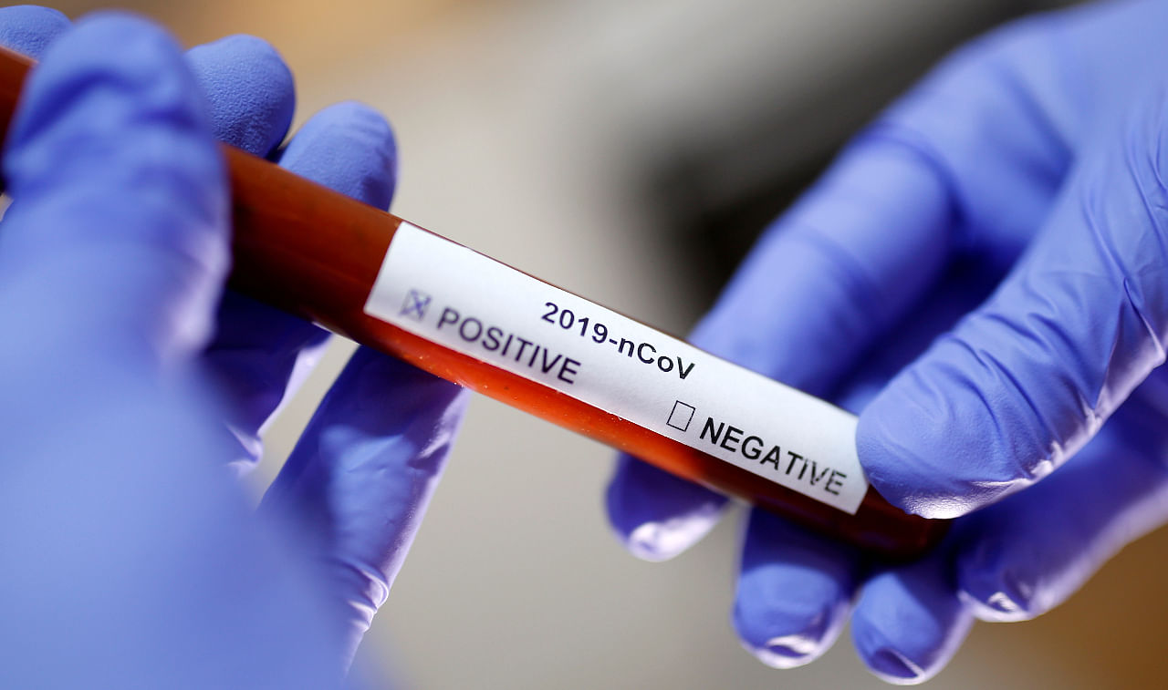 The 'Advisory on Strategy for Covid-19 Testing in India' (version VI) said the state governments can simplify the modalities to facilitate testing on demand. Representative image/Credit: Reuters Photo