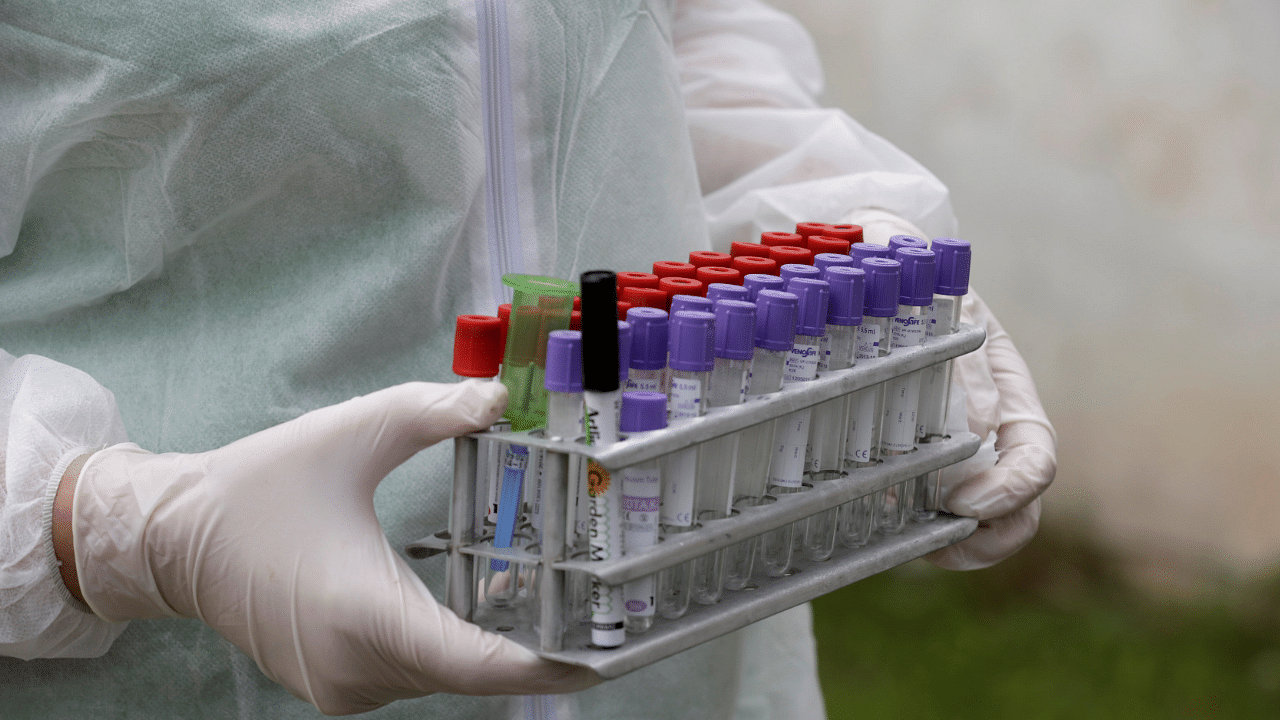 Inspector Vija Ritina holds blood test tubes to process a check on a farm in the Rezekne. Credits: Reuters Photo