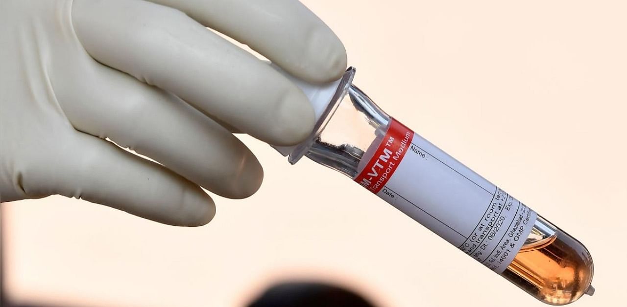 A medical worker holds a test tube after collecting swab a sample for a Rapid Antigen Test (RAT) for the Covid-19. Representative Photo. Credit: AFP