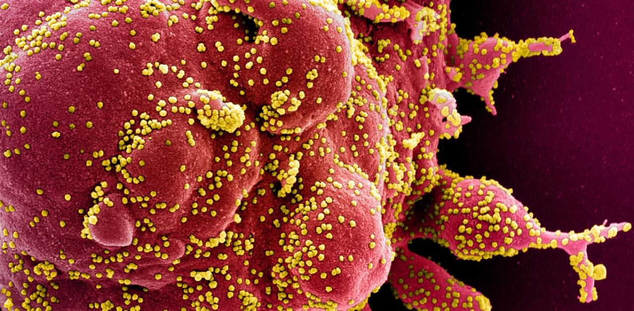Colorised scanning electron micrograph of an apoptotic cell (red) infected with SARS-COV-2 virus particles (yellow), also known as novel coronavirus, isolated from a patient sample. Credit: Reuters Photo