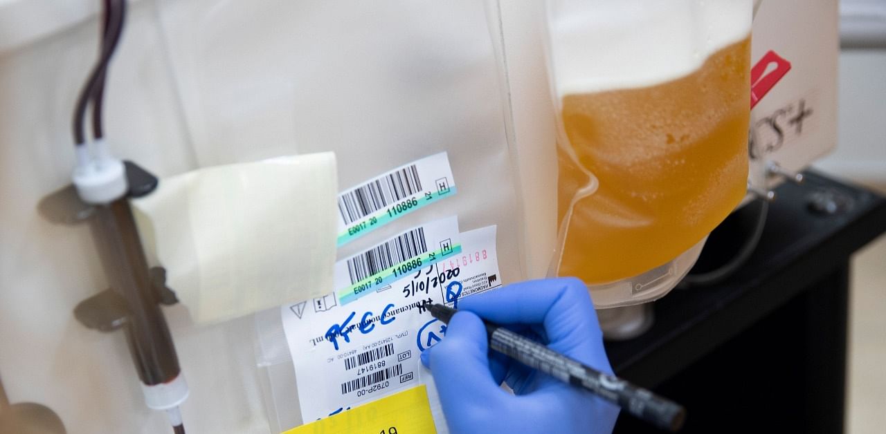 A laboratory technician prepares to process a bag of blood plasma from a donor. Credit: AFP Photo