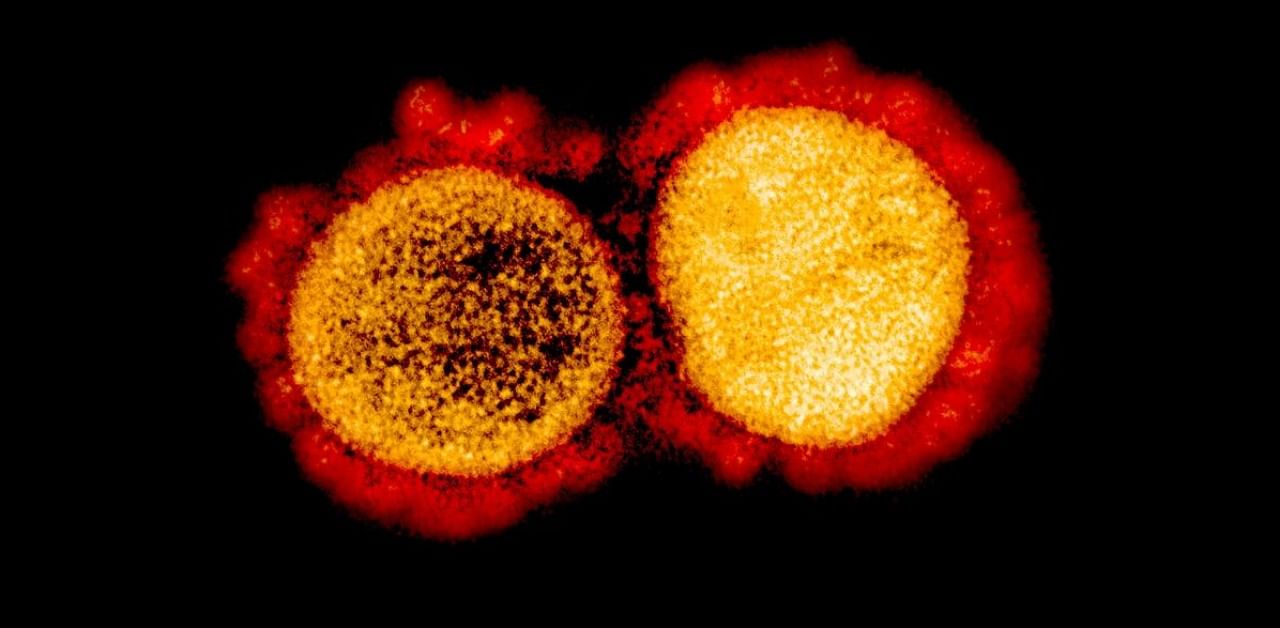 In this handout image, courtesy of the NIH/NIAID, shows a transmission electron micrograph of SARS-CoV-2 virus particles, isolated from a patient,captured and color-enhanced at the NIAID Integrated Research Facility (IRF) in Fort Detrick. Credit: AFP/Handout / National Institute of Allergy and Infectious Diseases.
