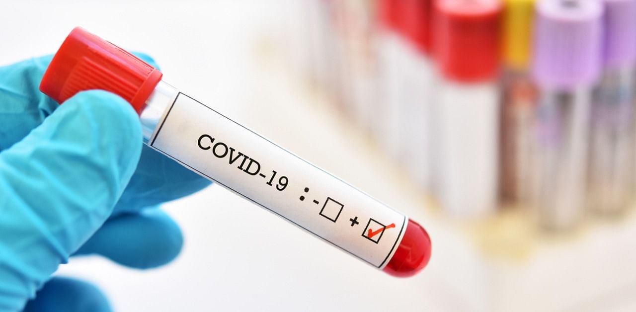 32 children at the Jawaharlal Nehru Girls Home at Narsingarh tested positive for coronavirus. Credit: iStock Photo