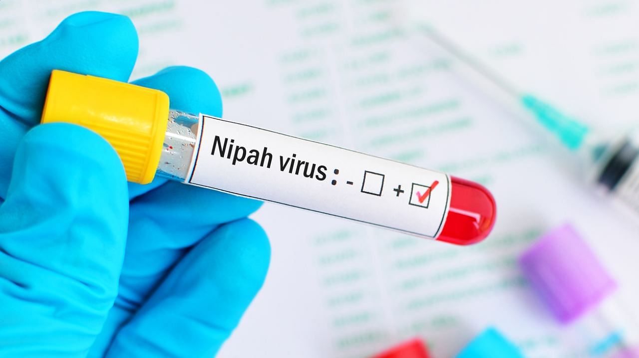 <div class="paragraphs"><p>Representative image of Nipah virus testing.</p></div>