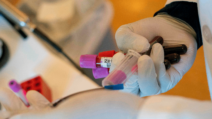 The decision to remove it from the guidelines comes in the backdrop of some clinicians and scientists writing to Principal Scientific Advisor K VijayRaghavan cautioning against the "irrational and non-scientific use" of convalescent plasma for Covid-19 in the country. Credit: AFP Photo