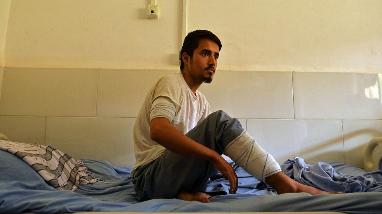 Abbas, who was injured in October 8 suicide bombing at the Gozar-e-Sayed mosque, is seen inside a regional hospital in Kunduz. Credit: AFP Photo