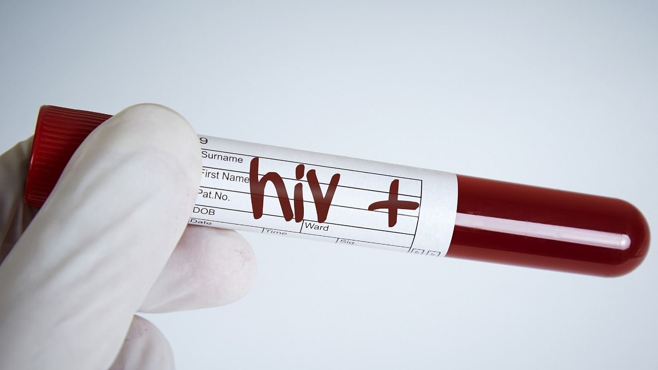 Out of 149 tested for HIV infection in 2021-22, two pregnant women have been tested for the infection. Credit: Getty Images