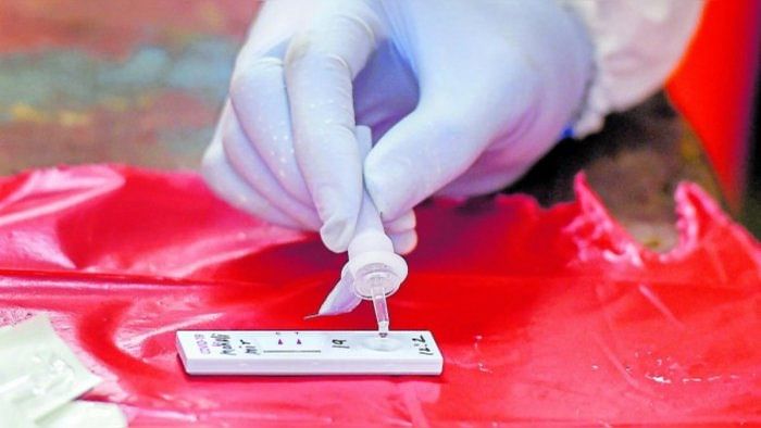 In Karnataka, authorities have little idea of how many RT-PCR, RAT self-testing kits are being sold in the state on a daily basis -- which the circular acknowledges. Credit: DH File Photo