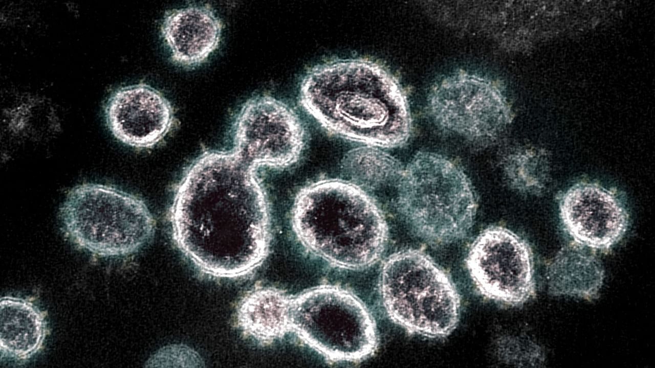 A transmission electron microscope image of SARS-CoV-2 virus. Credit: AFP Photo