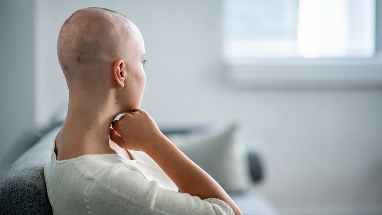 Some people with alopecia areata lose patches of hair only on their scalp, while others lose it elsewhere on their body as well. Credit: iStock Photo