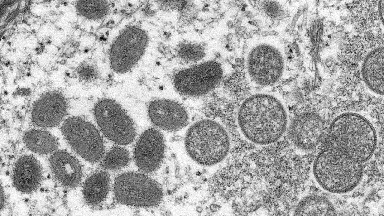 An electron microscopic (EM) image shows mature, oval-shaped monkeypox virus particles obtained from a clinical human skin sample associated with the 2003 prairie dog outbreak. Credit: Reuters photo
