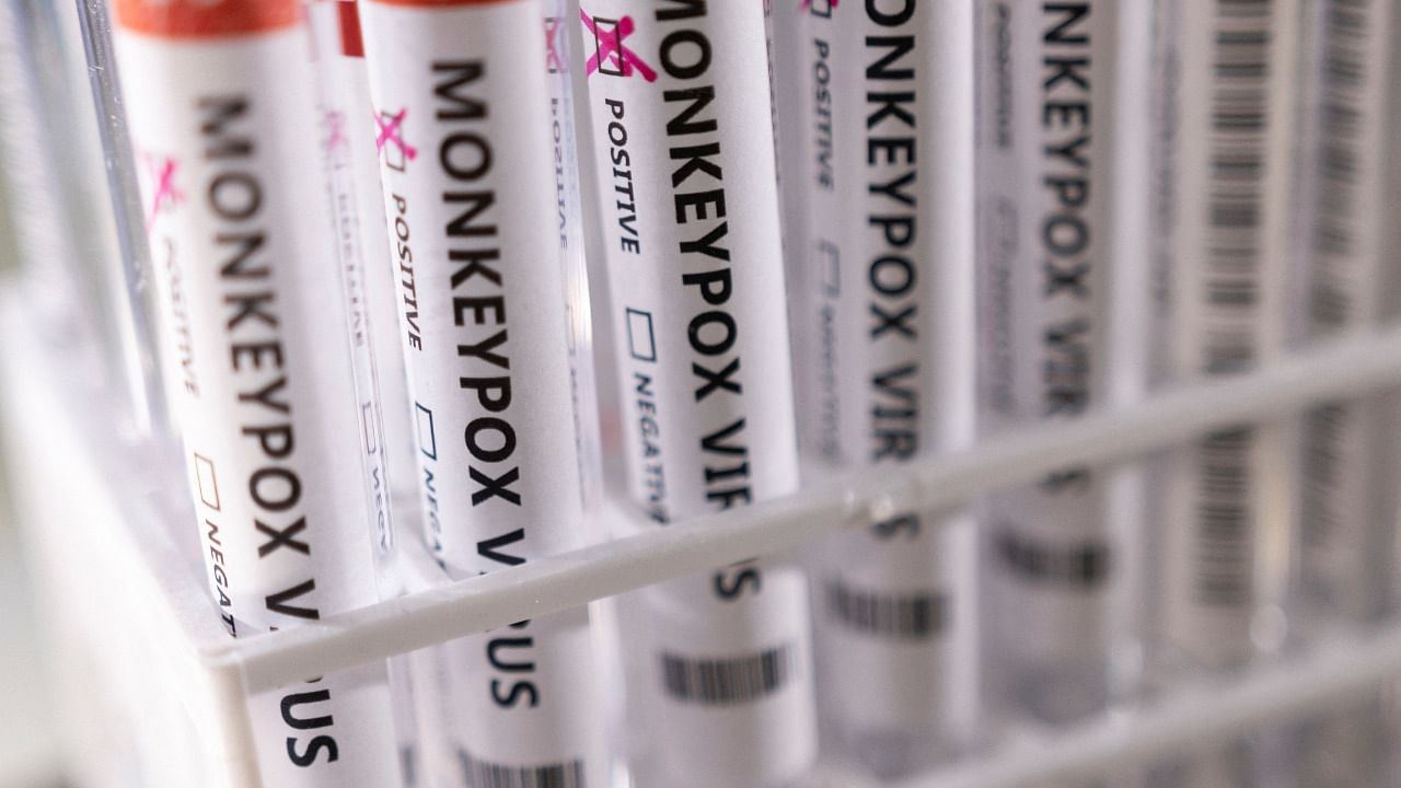 Test tubes labelled 'Monkeypox virus positive' are seen in this illustration taken. Credit: Reuters Photo