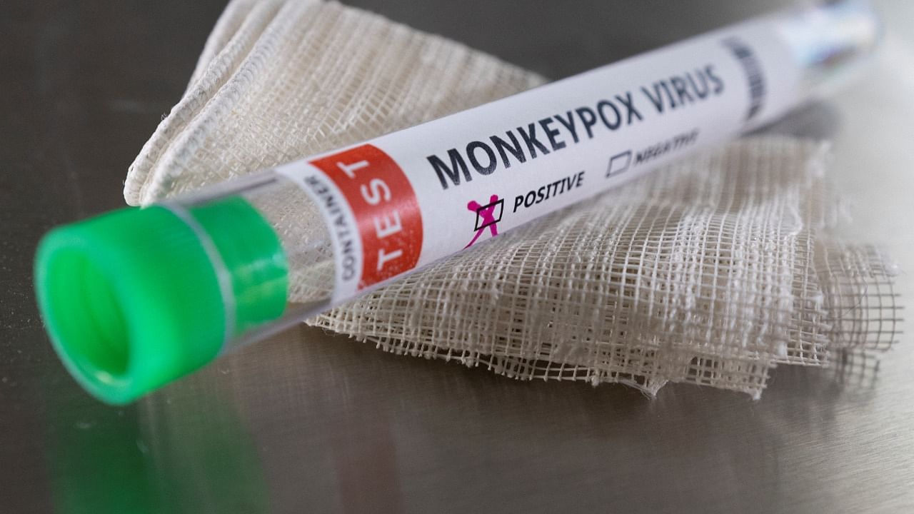 Illustration shows test tube labelled 'Monkeypox virus positive'. Credit: Reuters Photo
