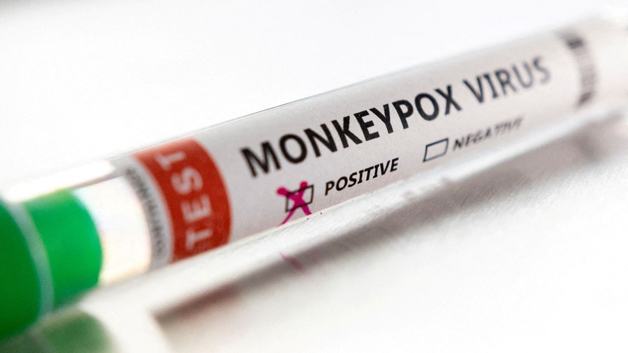 TN govt urges foreigners to report monkeypox symptoms. Credit: Reuters Photo