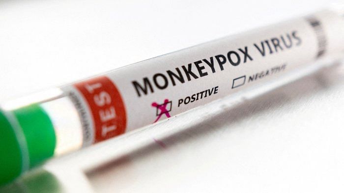 Monkeypox is a large DNA virus belonging to the orthopoxvirus family. Unlike the related smallpox virus, variola, which only affected humans, monkeypox virus is found in rodents and other animals in parts of Africa. Credit: Reuters File Photo